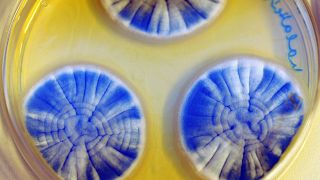 ARCHÍV, ILLUSZTRÁCIÓ: gombatelepek színezett táptalajon egy Petri-csészében, a DOTE Biotechnológiai és Mikrobiológiai Tanszékén  2017. 01. 17.