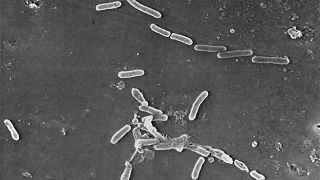 تصویری میکروسکوپی از ازدیاد باکتری‌ها