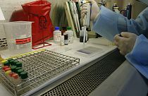 Δείγμα για εξετάσεις αίματος σε εργαστήριο - φώτο αρχείου