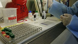 Δείγμα για εξετάσεις αίματος σε εργαστήριο - φώτο αρχείου
