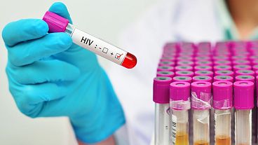The new HIV variant is more contagious but remains easily treatable.