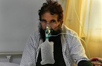 Un patient afghan infecté par le Covid-19 dans l'unité de soins intensifs d'un hôpital de Kaboul (Afghanistan), lundi 7 février 2022.