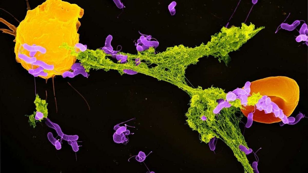 یک سلول نوتروفیل (زرد)، در حال آزاد کردن تله‌های موسوم به نت (سبز) برای به دام انداختن باکتری‌ها (بنفش)