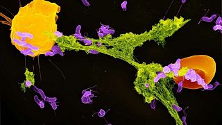 یک سلول نوتروفیل (زرد)، در حال آزاد کردن تله‌های موسوم به نت (سبز) برای به دام انداختن باکتری‌ها (بنفش)