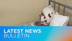 Latest news bulletin | February 19th – Morning