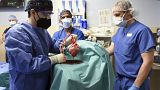 Doctors at the University of Maryland School of Medicine carry out the world's first pig-to-human heart transplant.