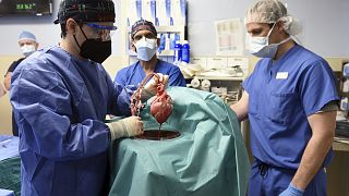 Doctors at the University of Maryland School of Medicine carry out the world's first pig-to-human heart transplant.