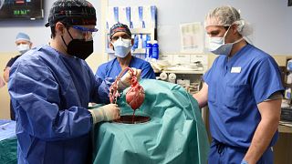 Archives : le cœur de cochon avant d'être greffé sur le patient, le 7 janvier 2022, par les équipes de l'école de médecine de l'Université du Maryland aux Etats-Unis