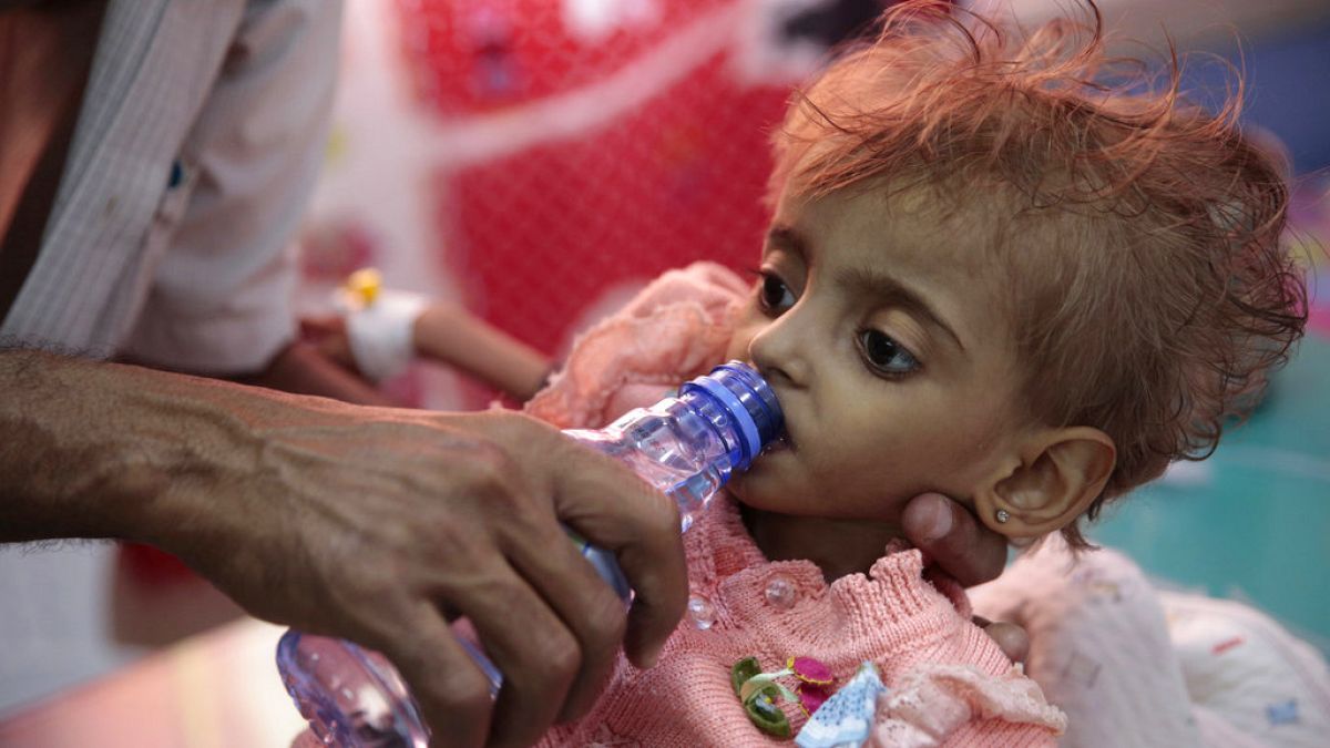 کودکان یمن از گرسنگی جان می‌سپارند