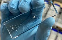 A “worm-on-a-chip” device tracks nematodes’ movements toward odor molecules produced by lung cancer cells.