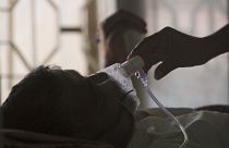 رجل يعدل قناع الأكسجين لمريض السل في مستشفى السل في اليوم العالمي لمكافحة السل في حيدر أباد - الهند. 2018/03/24