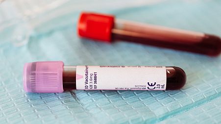 Microplastics are being found in people's blood