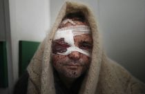 Un blessé à l'hôpital de Marioupol, le 11 mars