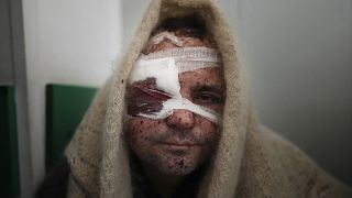 Un blessé à l'hôpital de Marioupol, le 11 mars