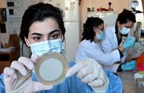 Tiflis'teki Eliava Enstitüsü bakteriyofajlar yani bakteri yiyen virüsler üzerine çalışıyor
