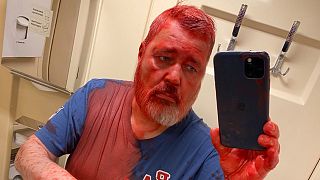 Nobel Peace Prize-winning newspaper editor Dmitry Muratov said he was attacked on a Russian train by an assailant who poured red paint on him.