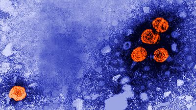 Microscope image of the hepatitis B virus