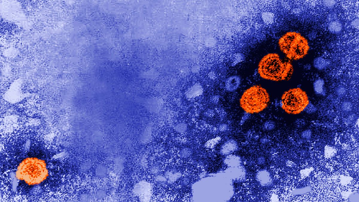 Mikroszkóp alatti felvétel a hepatitis B vírusról