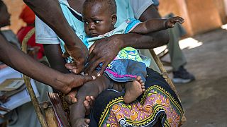 Un enfant atteint de malaria