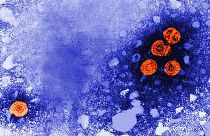 Hepatitis vírus
