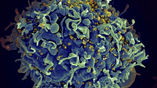 صورة مجهرية إلكترونية لخلية تائية بشرية، مشار إليها باللون الأزرق، تتعرض لهجوم من قبل فيروس نقص المناعة البشرية
