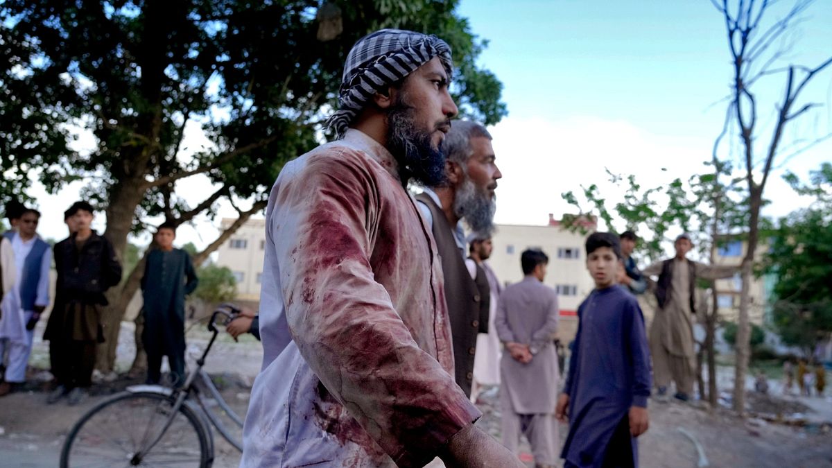 أفغاني ملطخ بالدماء بعد نجاته من التفجير 