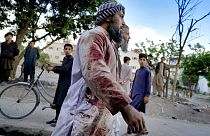 Un fidèle afghan ensanglanté près de la mosquée où a eu lieu l'explosion, à Kaboul, en Afghanistan, vendredi 29 avril 2022.