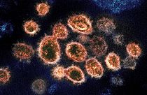 Covid-19'a neden olan SARS-CoV-2 virüs partikülleri