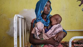 Une femme tient son enfant malnourris dans l'unité de nutrition du centre de Kelafo, au Sud-Est de l'Ethiopie