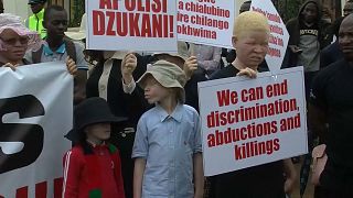 Malawian court sentences three to 155 years for albino murder