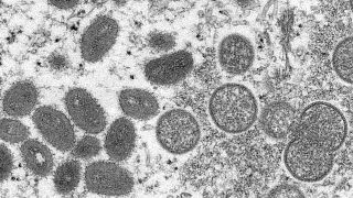 This 2003 electron microscope image shows mature, oval-shaped monkeypox virions, left, and spherical immature virions, right, 