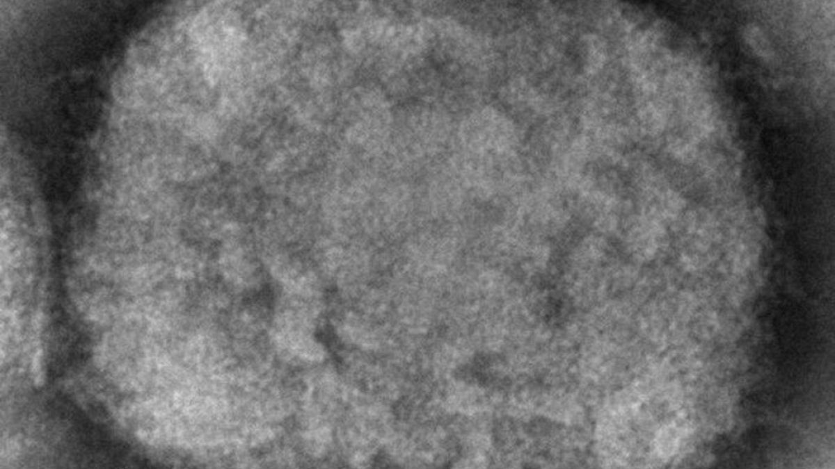Εικόνα του ιού της ευλογιάς των πιθήκων από ηλεκτρικό μικροσκόπιο, εικόνα αρχείου