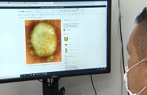 Ερευνητής μελετά εικόνα του ιού της ευλογιάς των πιθήκων- εικόνα αρχείου