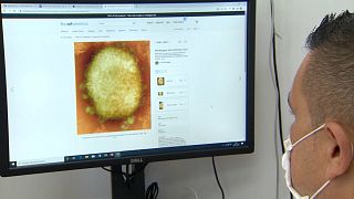 Un científico observa el virus de la viruela del mono en una pantalla de ordenador