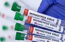  أنابيب تحوي عينات إيجابية أو سلبية من مشتبه بإصابتهم بفيروس جدري القردة - 23 مايو 2022.