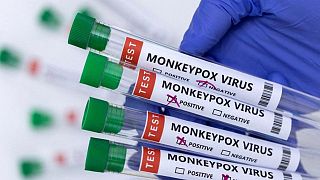  أنابيب تحوي عينات إيجابية أو سلبية من مشتبه بإصابتهم بفيروس جدري القرود - 23 مايو 2022.