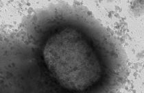 Maymun Çiçeği virüsünün mikroskobik görüntüleri