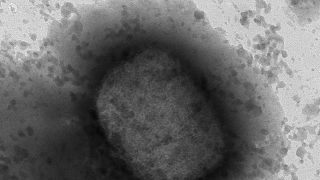 Maymun Çiçeği virüsünün mikroskobik görüntüleri