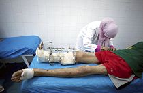 Settembre 2011, un combattente ferito in un ospedale di Misurata, Libia