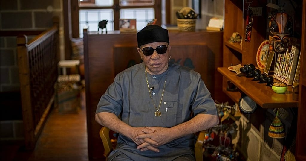 Salif Keita says countries should do more to protect albinos - Vimarsana News