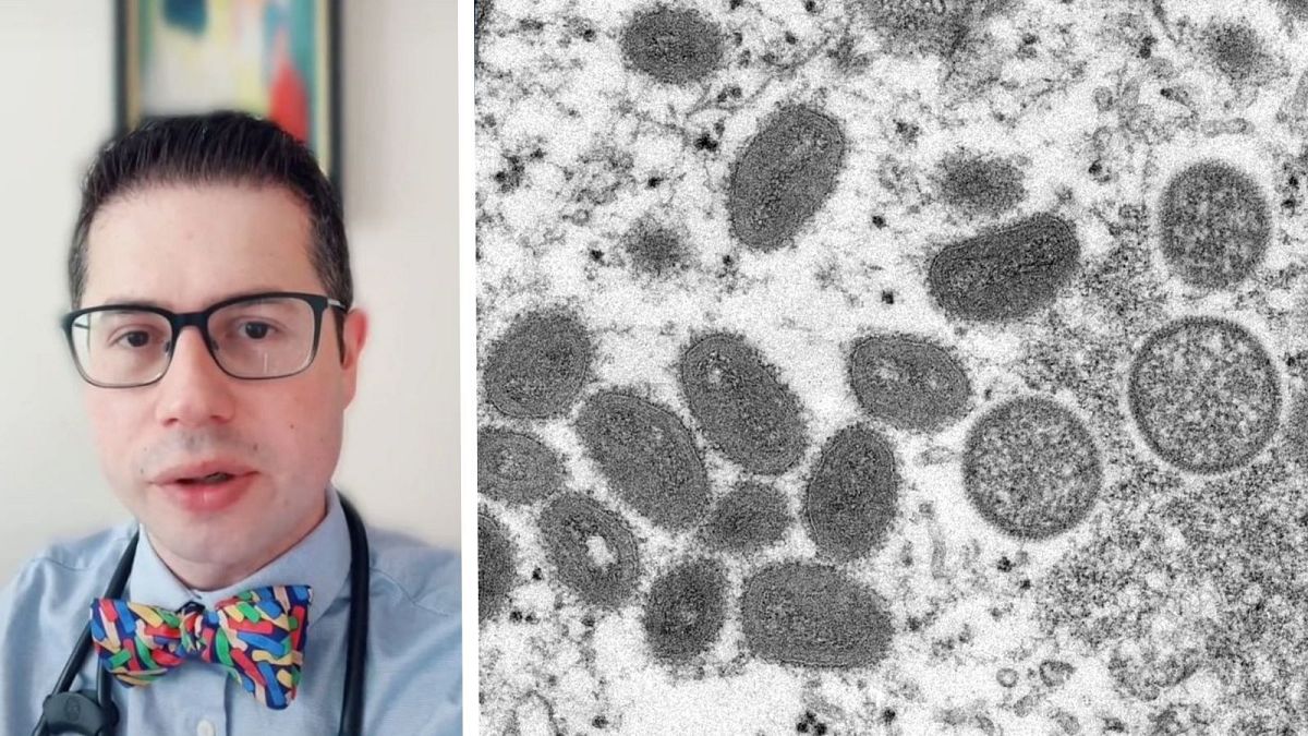 Dr. Zachary Rubin has been fighting monkeypox misinformation on his TikTok account
