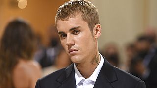 Justin Bieber says a rare disorder has paralysed half of his face and he has to postpone upcoming shows.