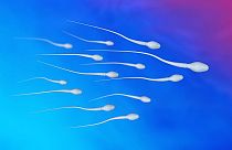 Die Qualität von Spermien bei Männern in westlichen Ländern nimmt weiter ab. Ein Grund könnten Schadstoffe sein, die Forscher:innen jetzt in Urinproben nachgewiesen haben.
