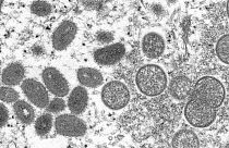 Image prise au microscope de virions mûrs de forme ovale de la variole du singe et de virions immatures sphériques.