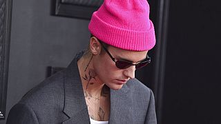 In einem Instagram-Video zeigt Bieber seinen Followern die Folgen des Ramsay-Hunt-Syndroms: Die Hälfte seines Gesichts ist gelähmt. 