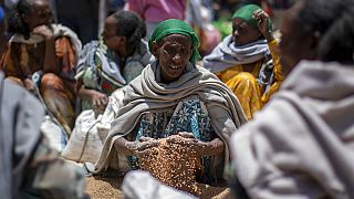 Children in Ethiopia face severe malnutrition 
