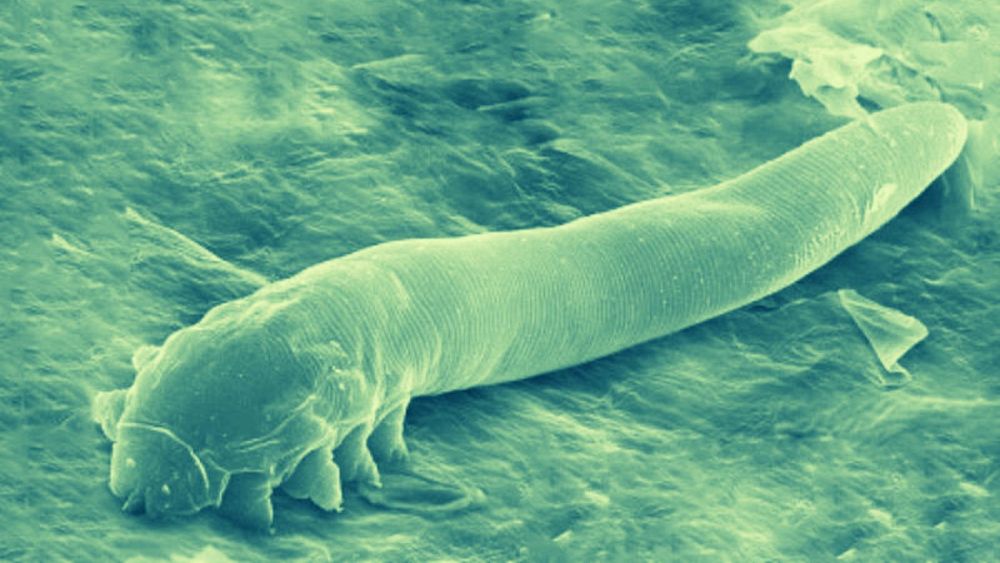 meet-the-skin-mites-that-eat-from-your-pores-and-mate-while-you-sleep