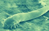 Around 90 per cent of humans have these mites living on them