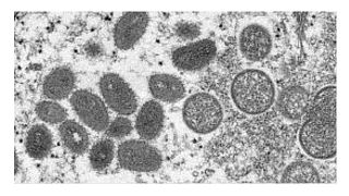 فيروسات جدري القرود كما تبدو في الصورة التي التقطت بمجهر إلكتروني في العام 2003، ونشرها مركز السيطرة على الأمراض والوقاية منها في الولايات المتحدة الأميركية