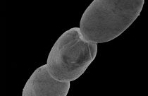 أكبر بكتيريا في العالم.